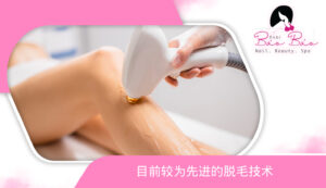 Các công nghệ triệt lông tốt nhất CN