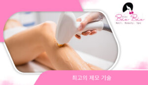 Các công nghệ triệt lông tốt nhất KO