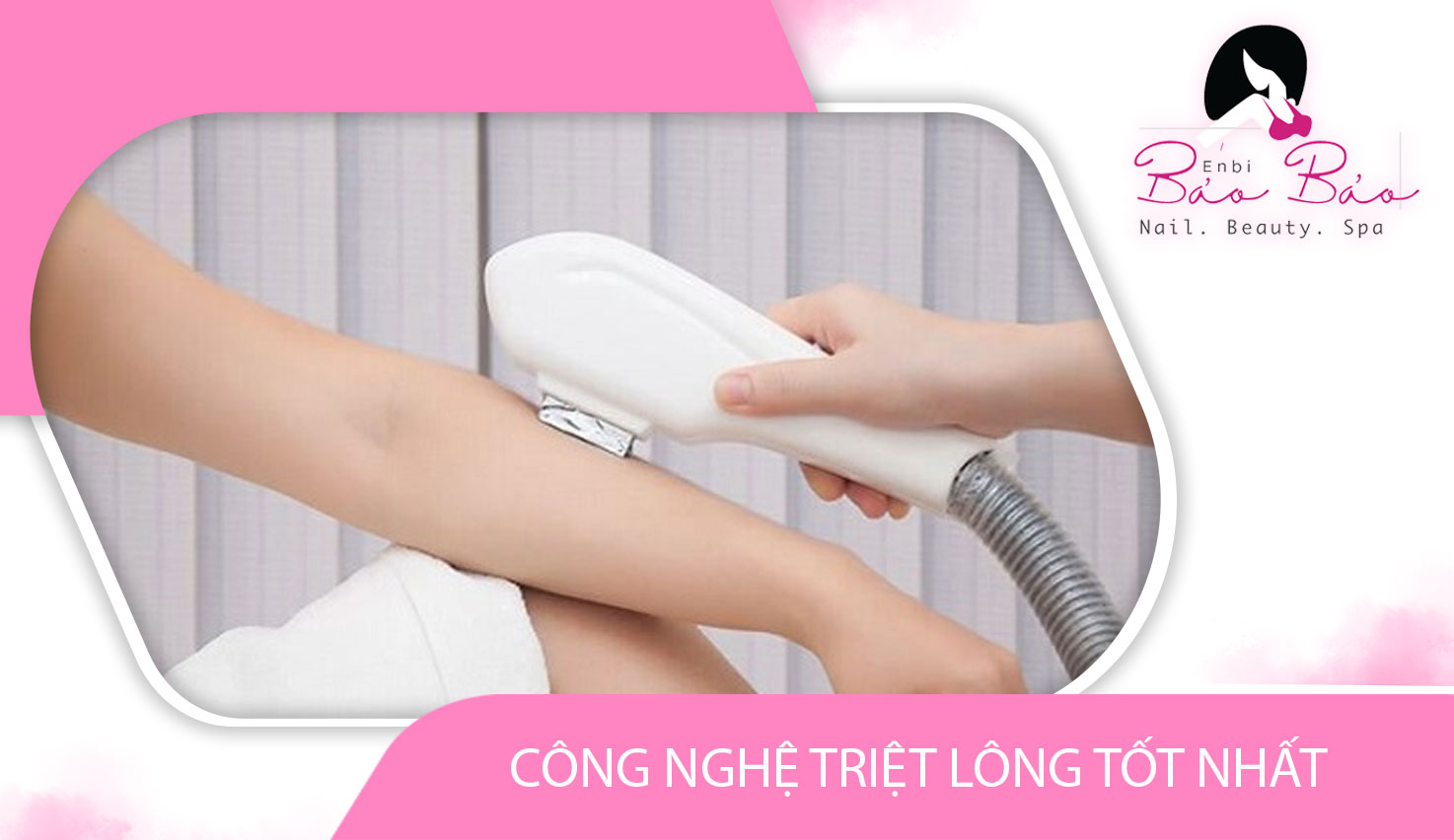 Các công nghệ triệt lông tốt nhất hiện nay