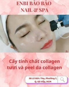 Cấy tinh chất collagen tươi và peel da collagen Gò Vấp