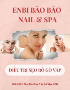 Điều trị sẹo rỗ