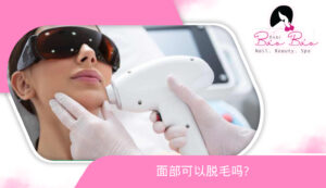Có nên triệt lông mặt không CN