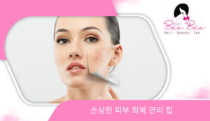 10 mẹo phục hồi da hư tổn KO