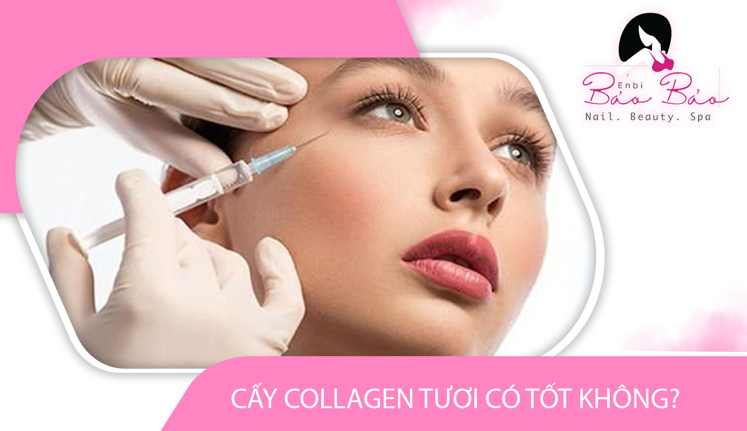 Cấy Collagen Tươi Có Đau Không? Tìm Hiểu Để Yên Tâm Làm Đẹp